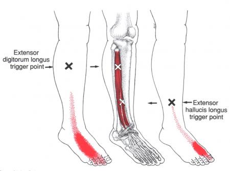 足の痛み しびれ 改善できる症状 草加市 痛み しびれがスッキリ消える トリガーポイント セラピー専門のひじりボディケアー